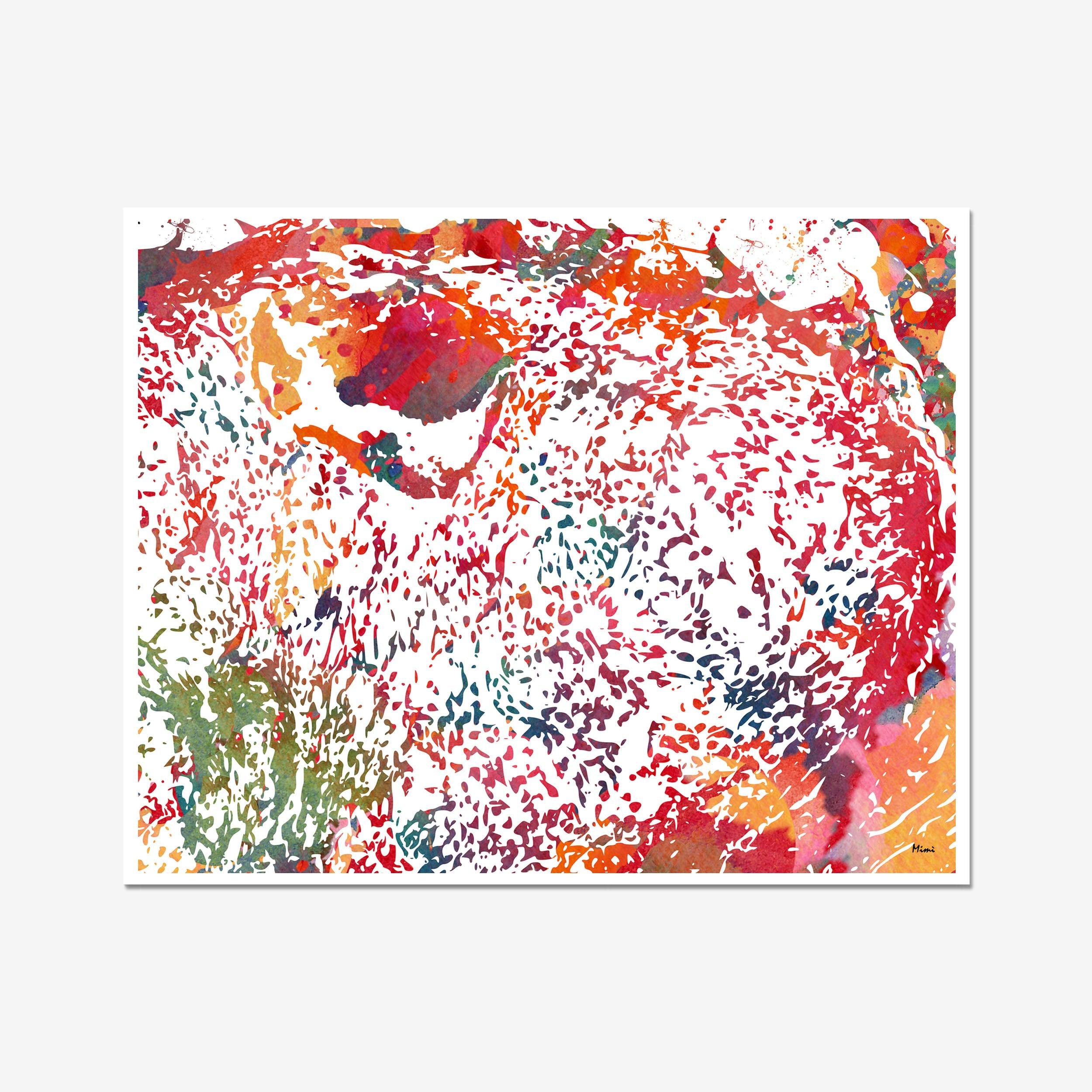 Close-up of chondrosarcoma watercolor print showing paper texture and grain