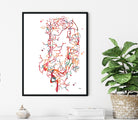 Brain Aneurysm Watercolor Print Cerebral Aneurysm Anatomy Image 2