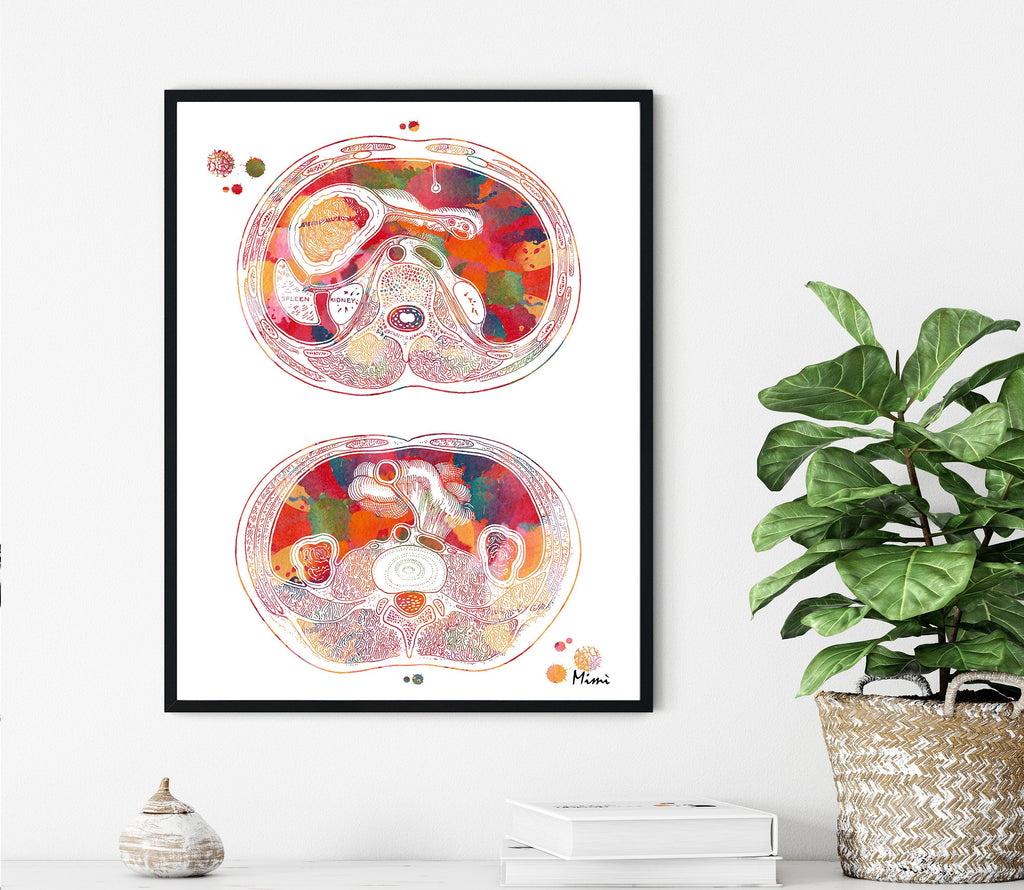 Abdomen Cross Section Anatomy Art Print | MimiPrints Anatomy Art Prints ...