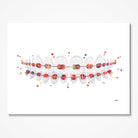 Orthodontic Braces watercolor art print for orthodontic clinic wall decor