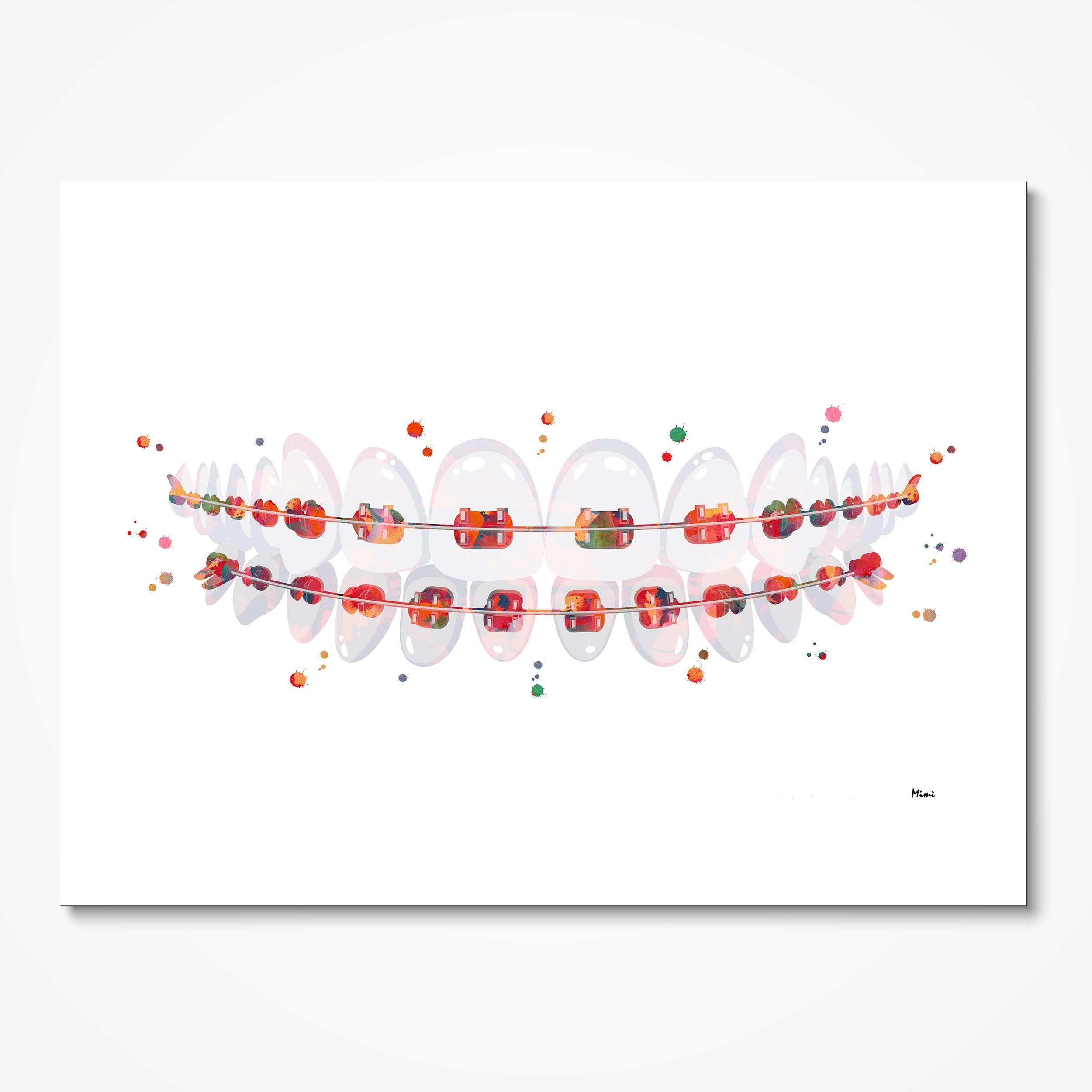 Orthodontic Braces watercolor art print for orthodontic clinic wall decor