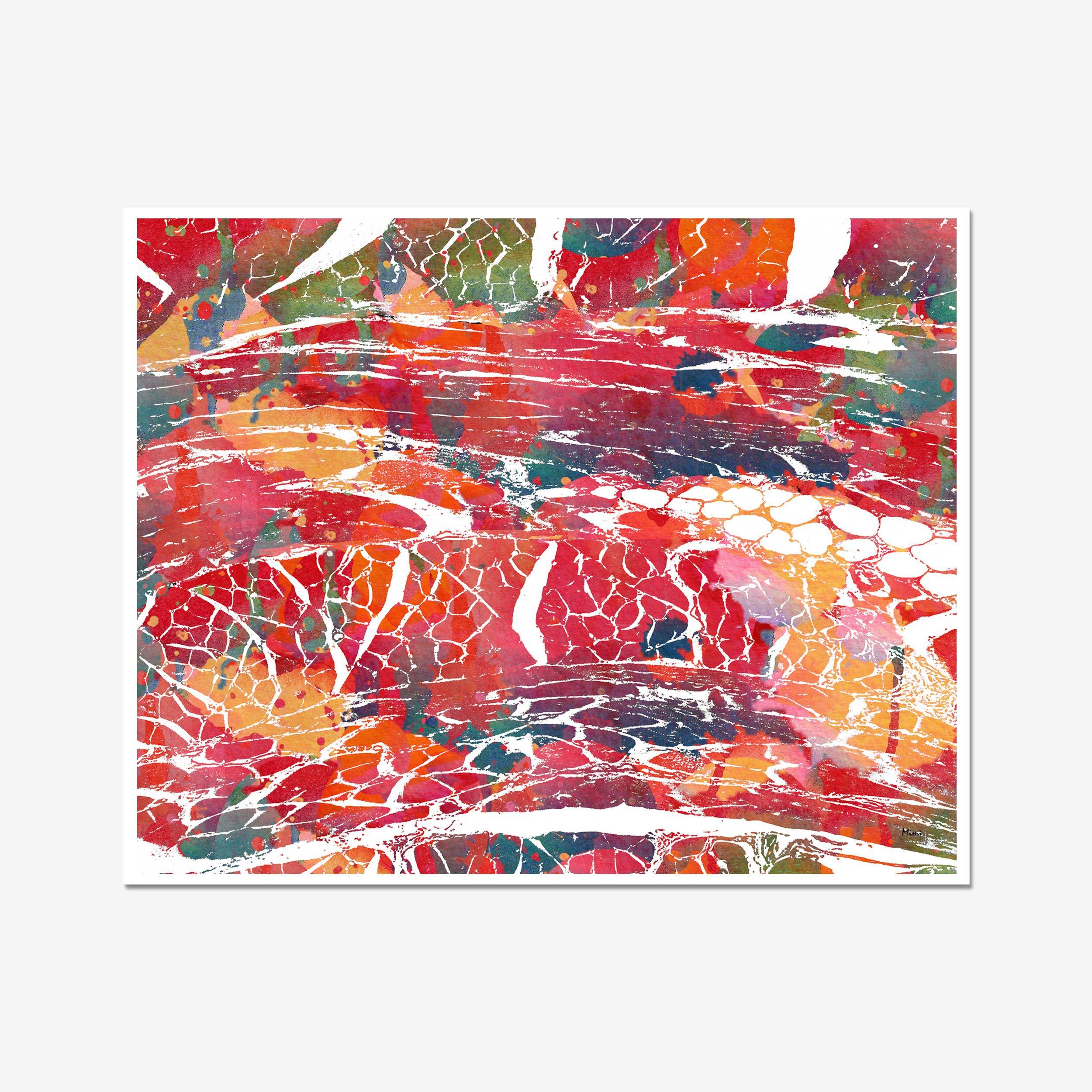 Skeletal Muscle Histology watercolor art print for orthopedic clinic wall decor